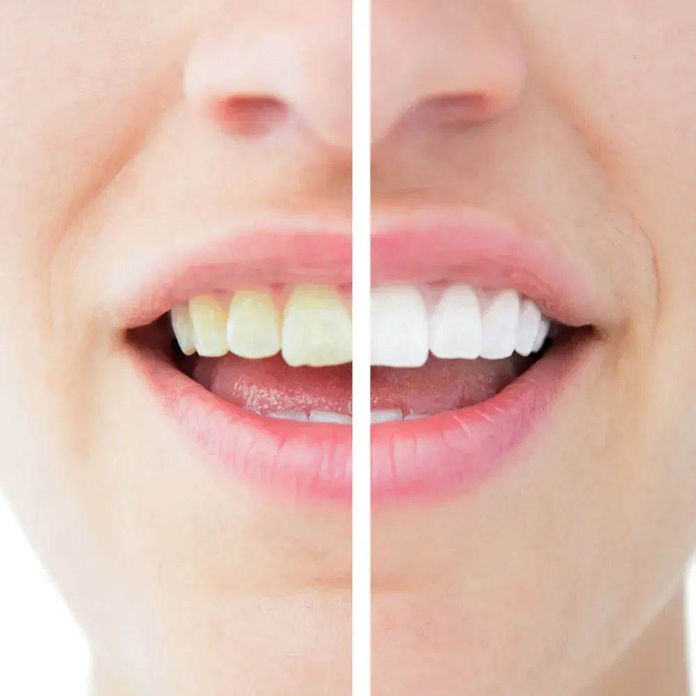 smiles-creator-3-1