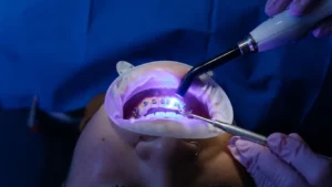 Sedation Dentistry