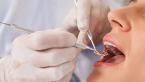 Emergency Dentist