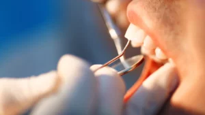 Emergency Dentist