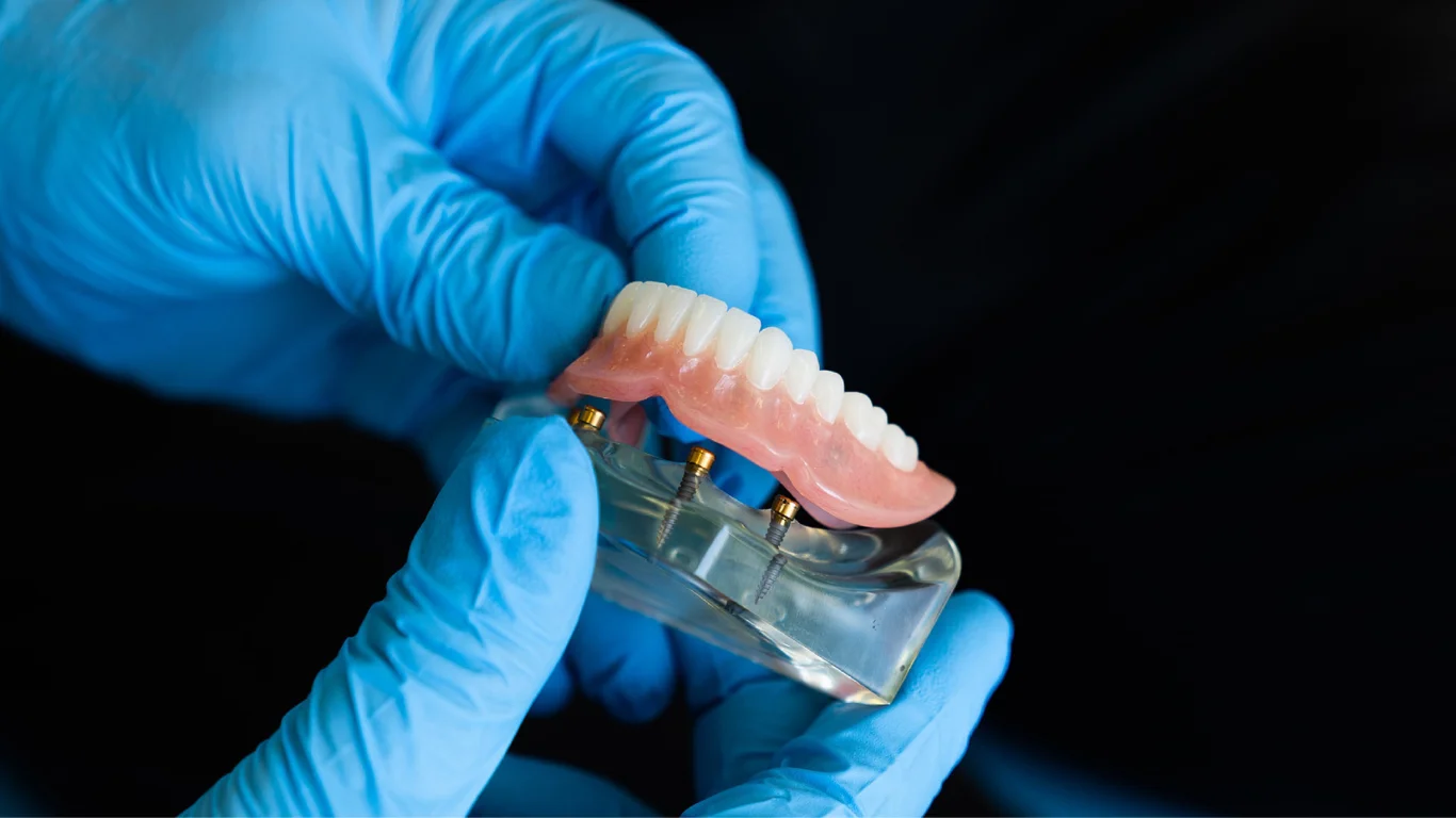 Implant Dentist