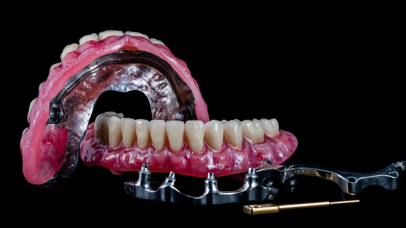 All on 4 Dental Implants
